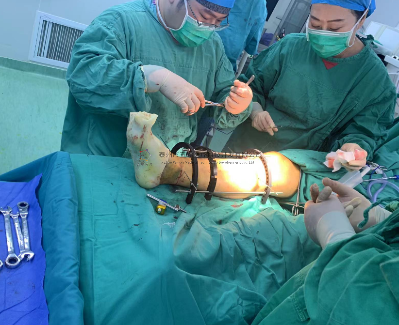 【望京醫(yī)院】不開刀治骨折病例分享——脛骨遠端骨折腓骨骨折